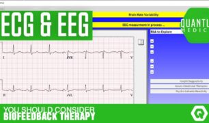 ECG EEG