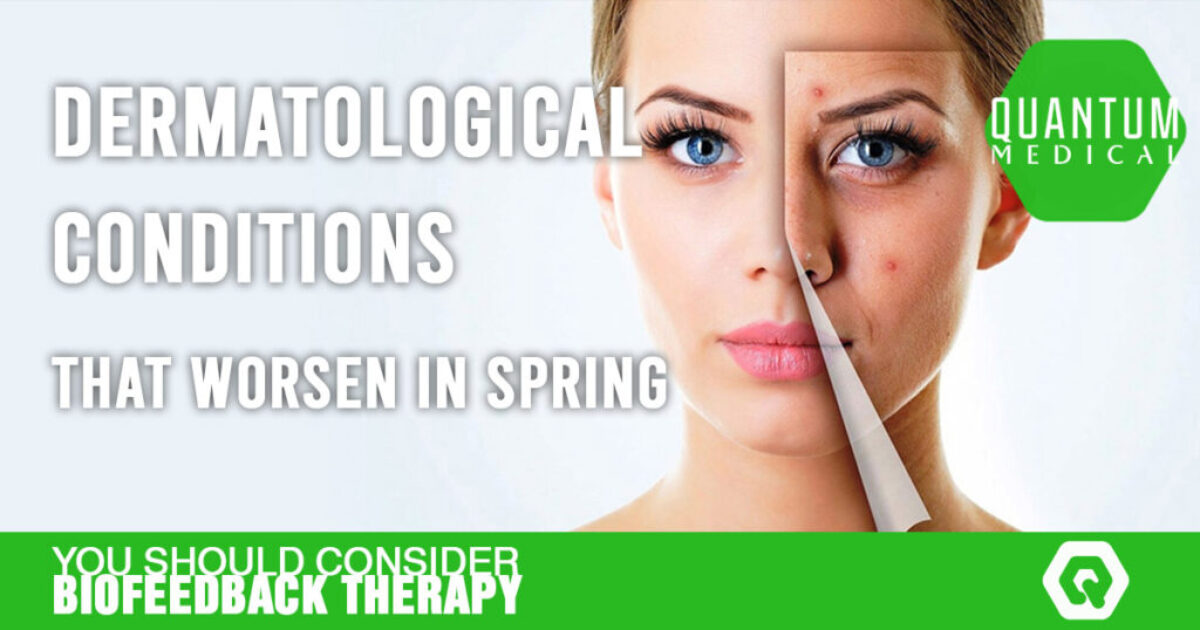 Dermatological conditions that worsen in spring