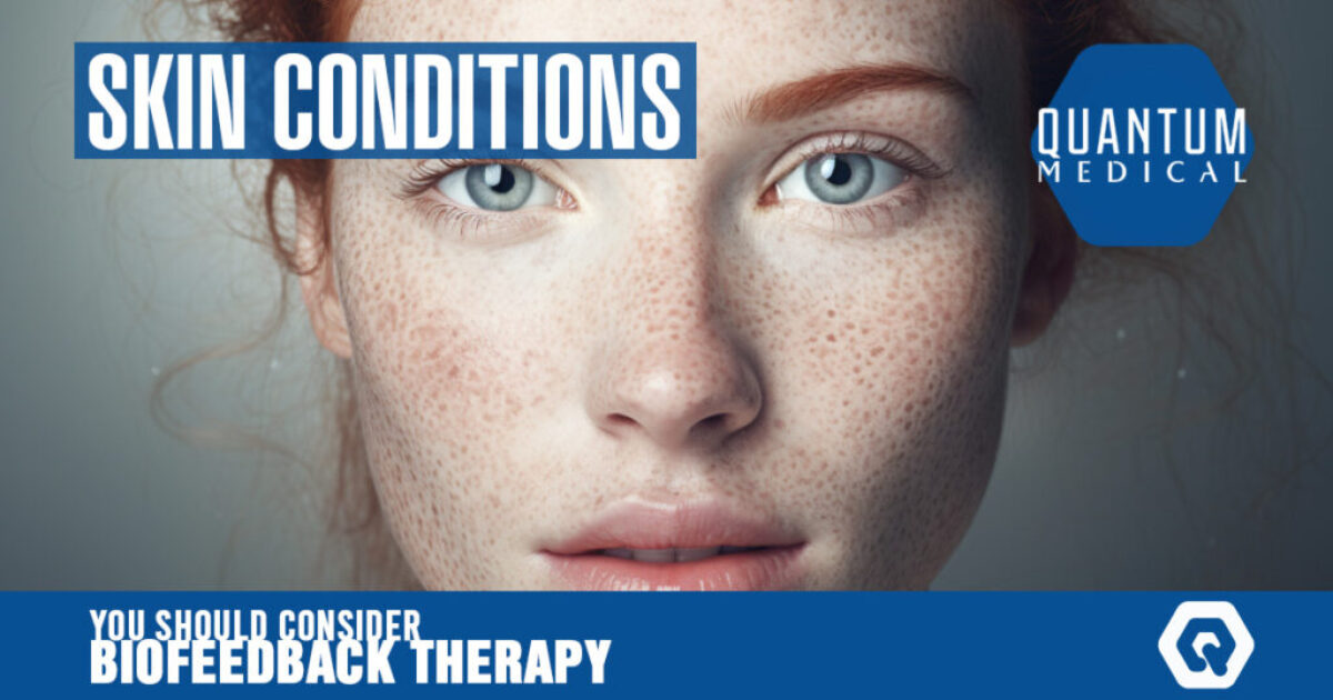 Skin conditions
